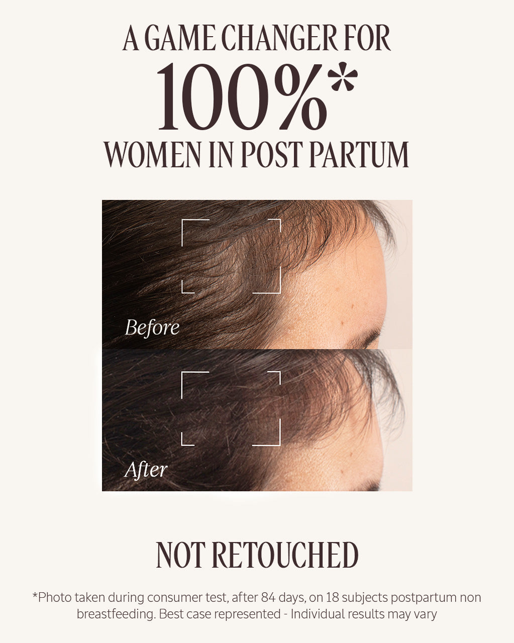 Anti-Hair Loss