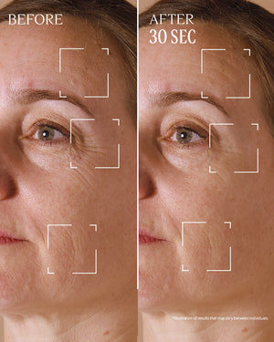 Immortelle Divine Targeted Wrinkle Care